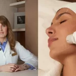 ultherapy prime