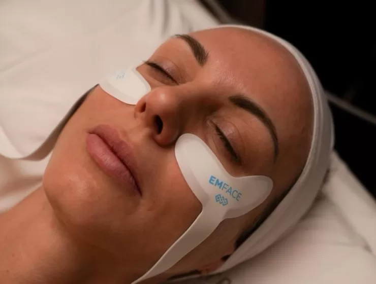 musculatura facial