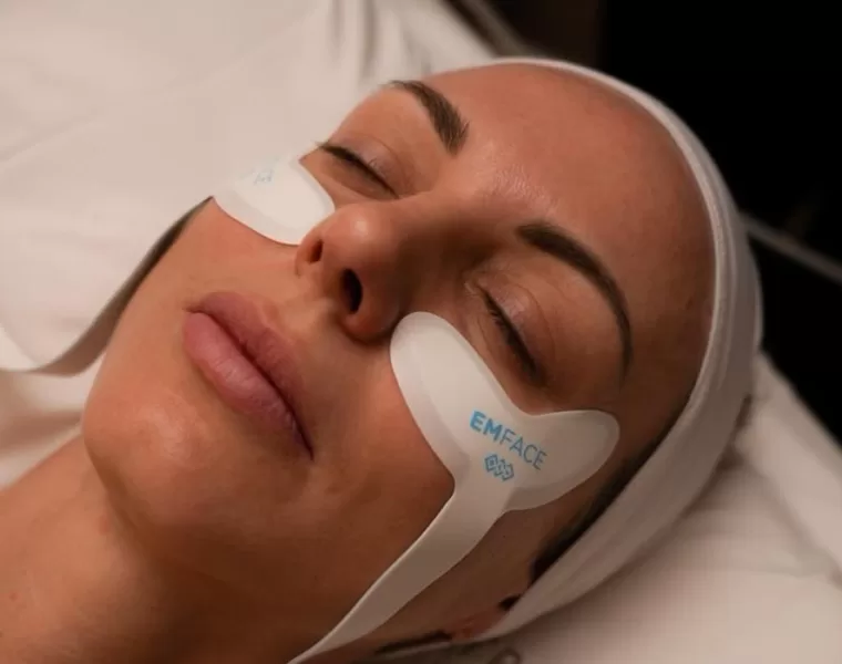 musculatura facial