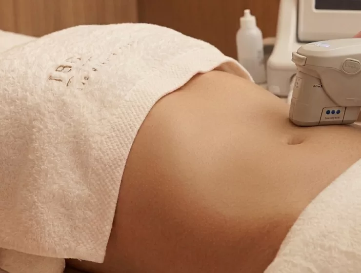 ultherapy prime corporal