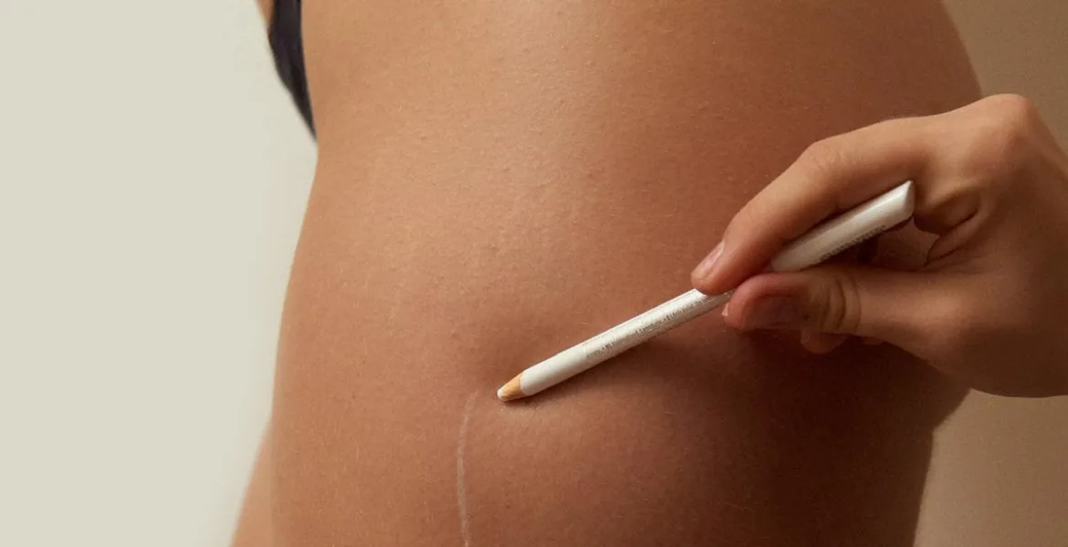 celulitis