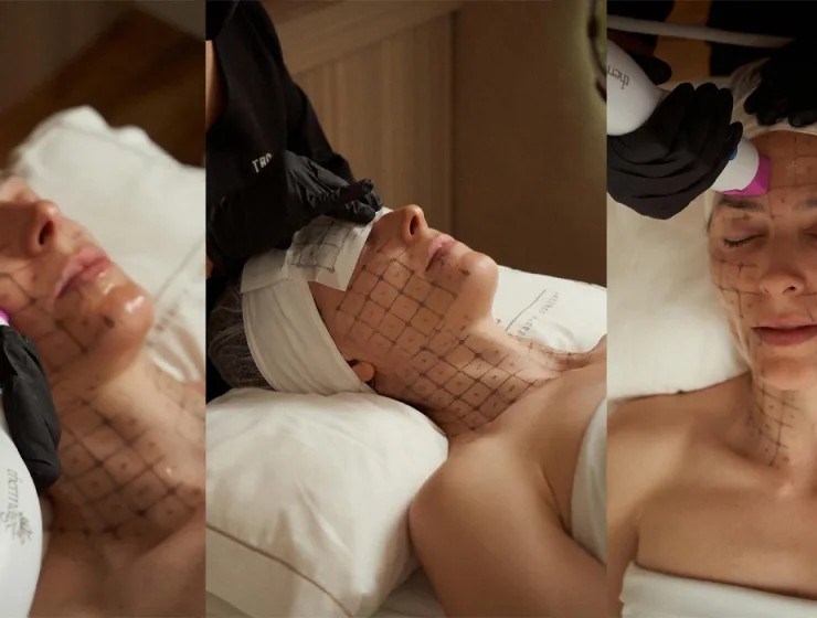 thermage flx rostro