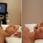 hydrafacial syndeo