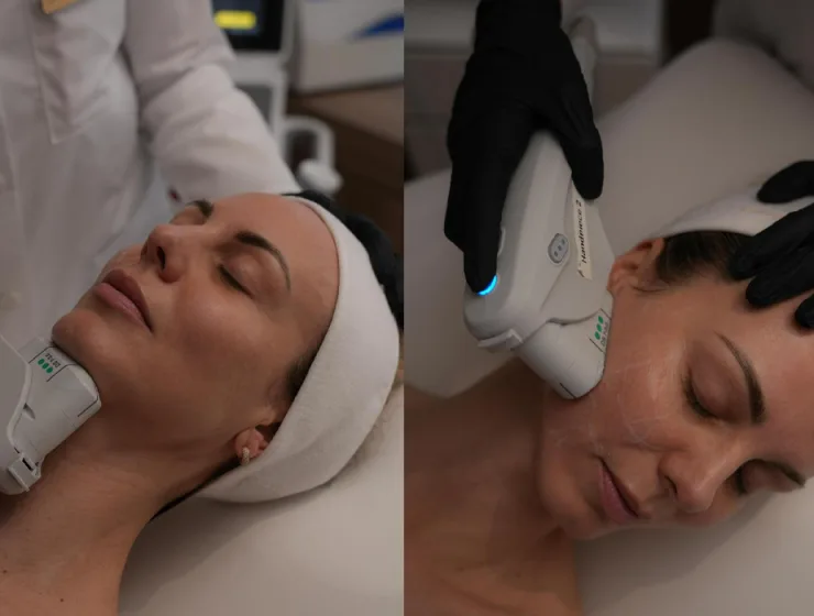 ultherapy prime