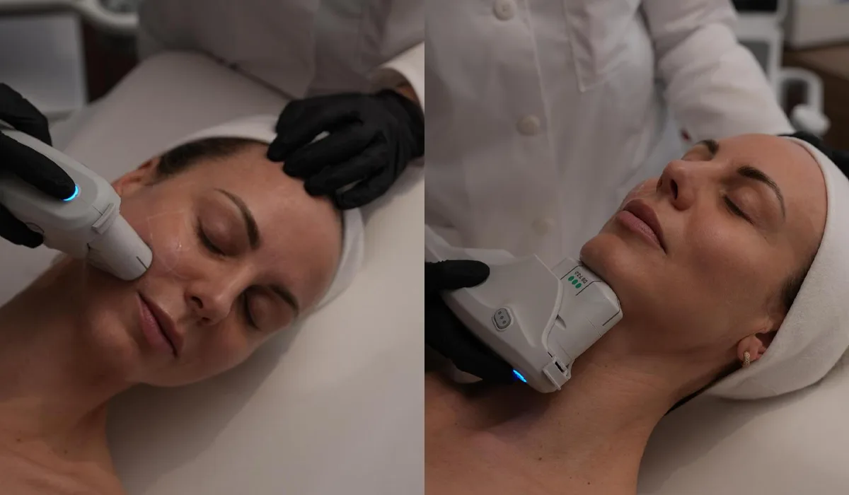 ultherapy prime y thermage flx
