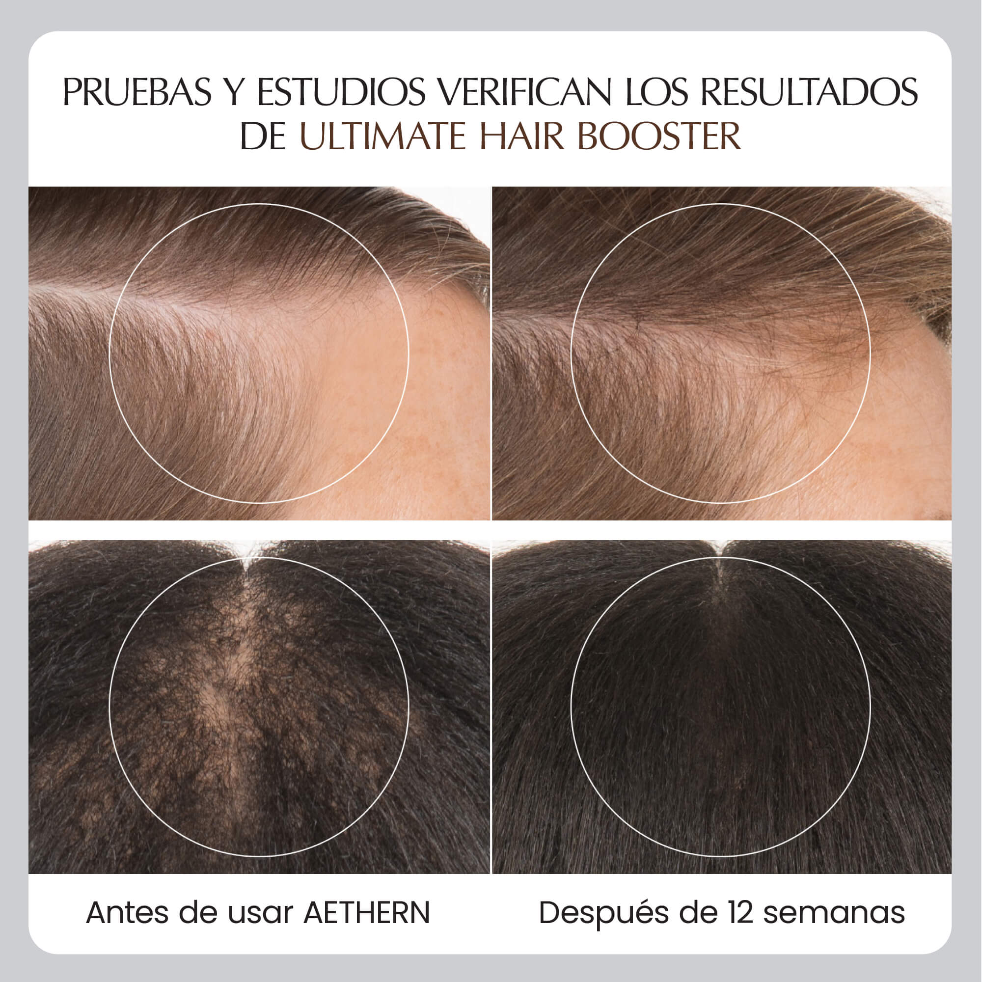 Ultimate Hair Booster Aethern