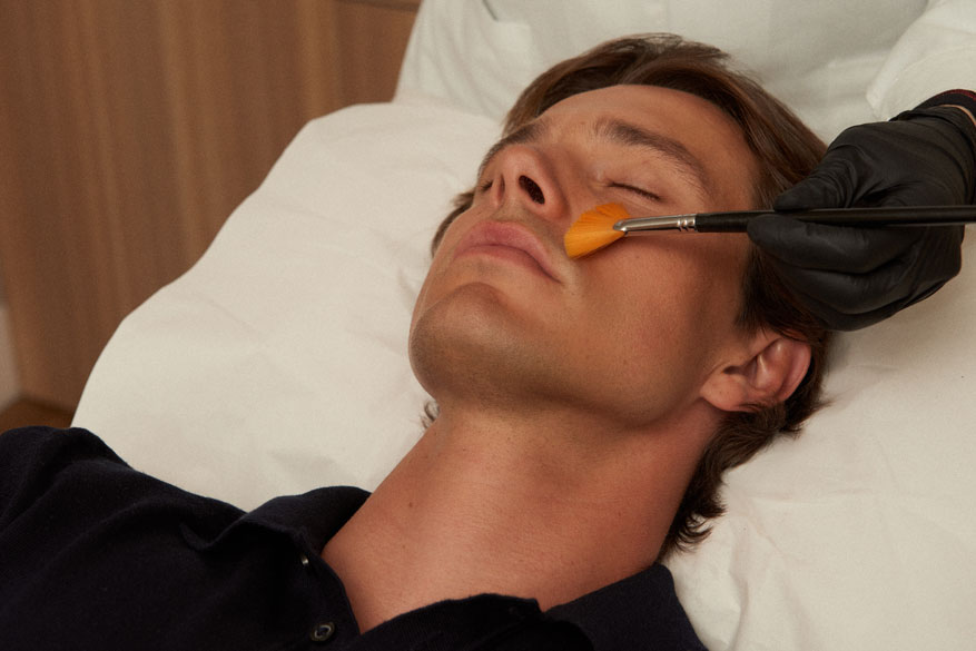 Tratamientos personalizados Acné