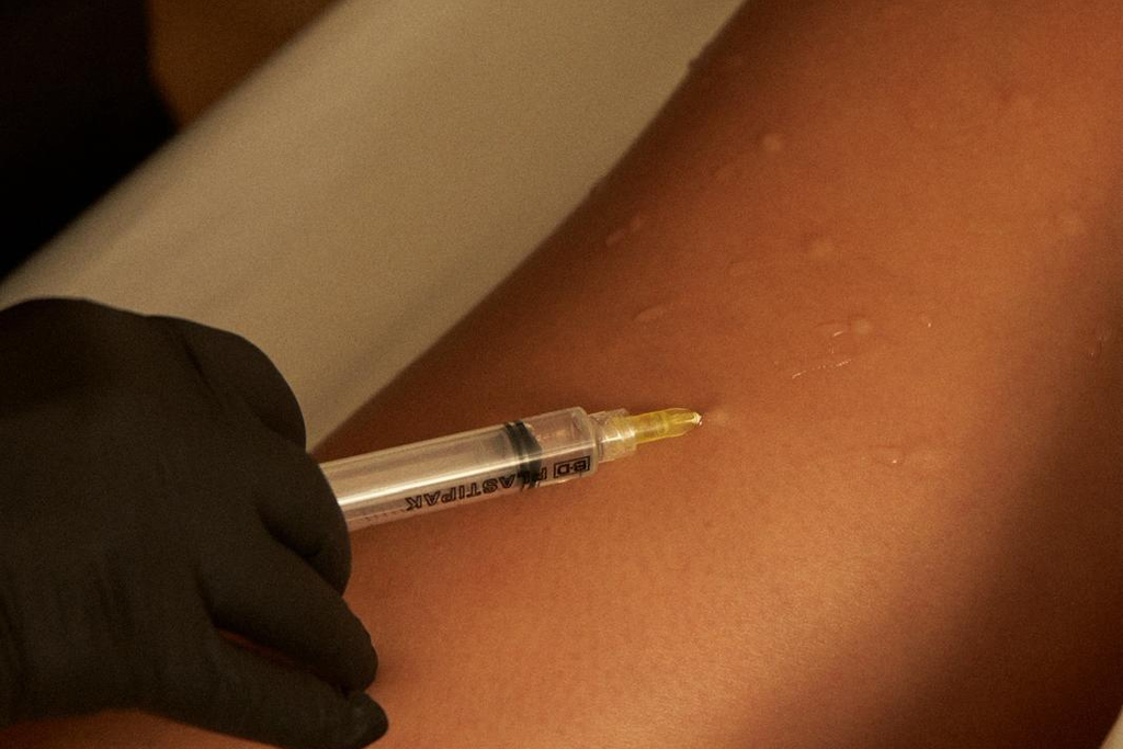 Carboxiterapia y Mesoterapia contra la celulitis